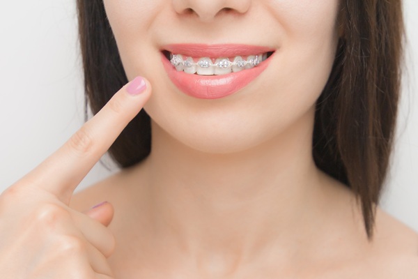 Proper Care For Clear Braces