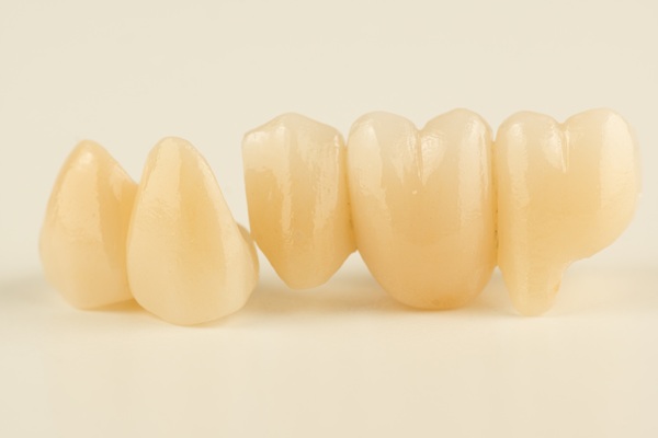 Types Of Dental Bridges: Choosing The Right Option For Your Smile
