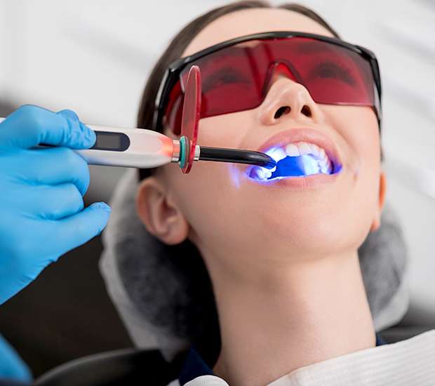 Nashua Professional Teeth Whitening