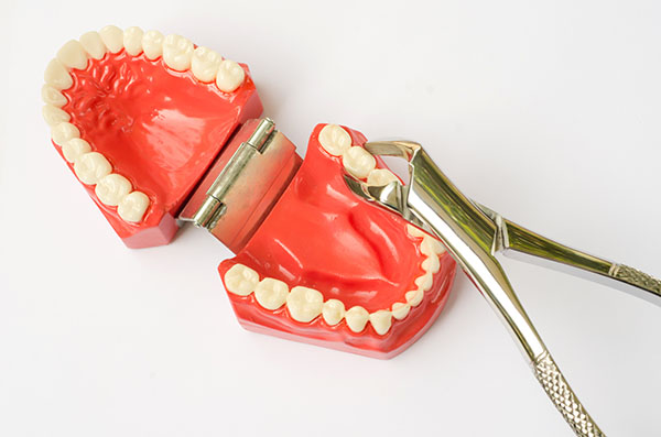 Wisdom Tooth Extractions: How Do You Know If Your Wisdom Teeth Need To Come Out?